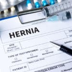 Physiomesh Hernia Lawsuit