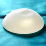 Allergan Breast Implant Lawsuit