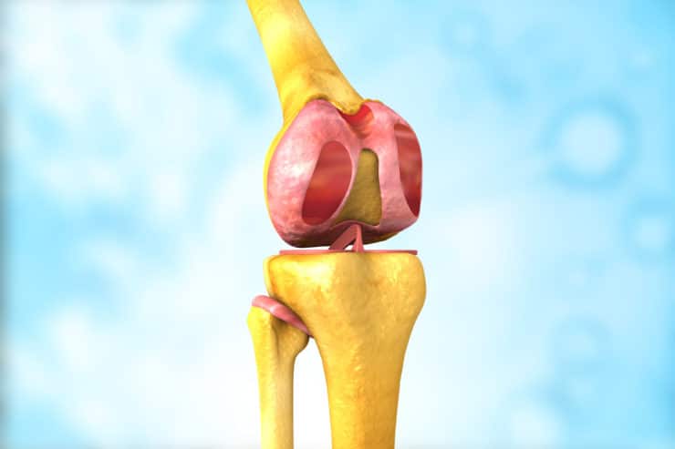 DePuy Knee Replacement Lawsuit