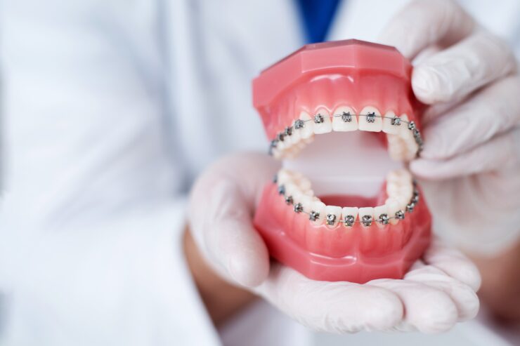 AGGA or FAGGA Dental Device Injury Lawsuit